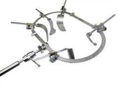 Bookwalter Retractor